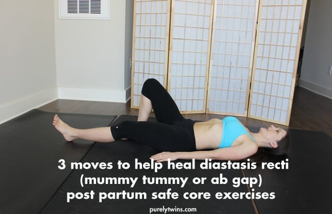 exercise-heal-diastasis-recti