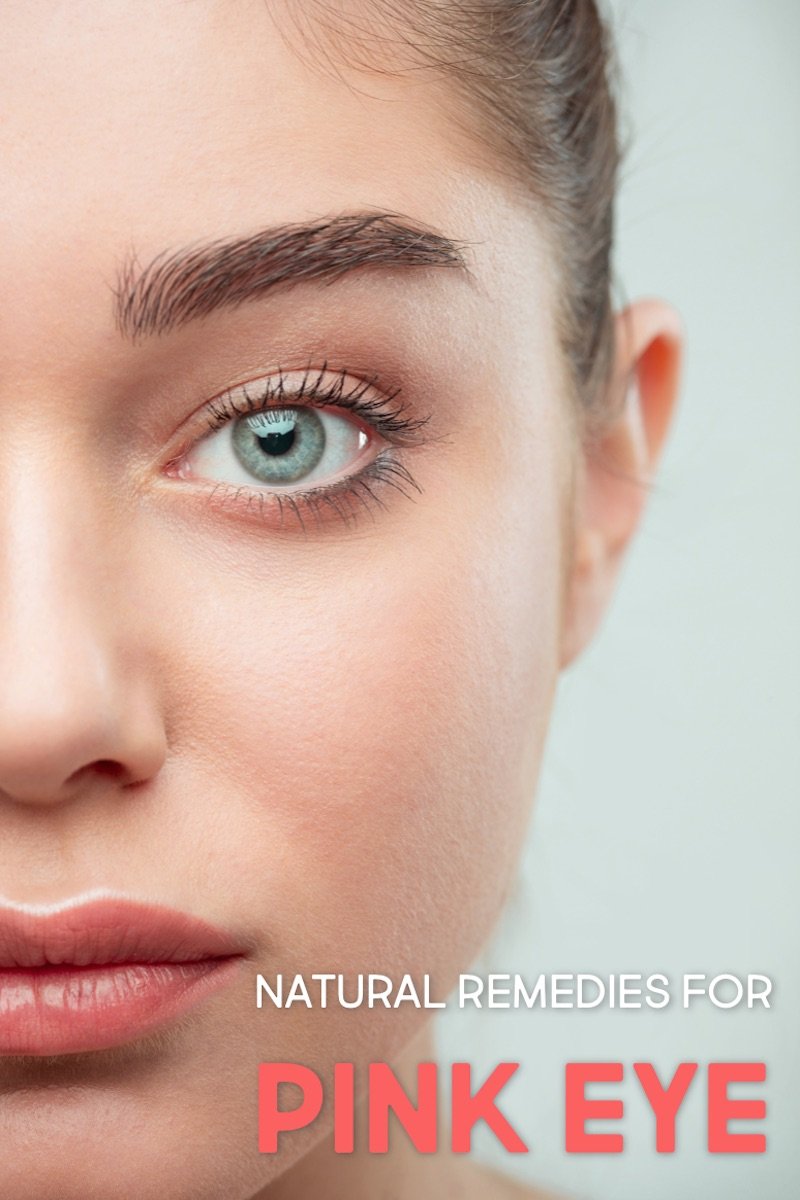 natural remedies for pink eye
